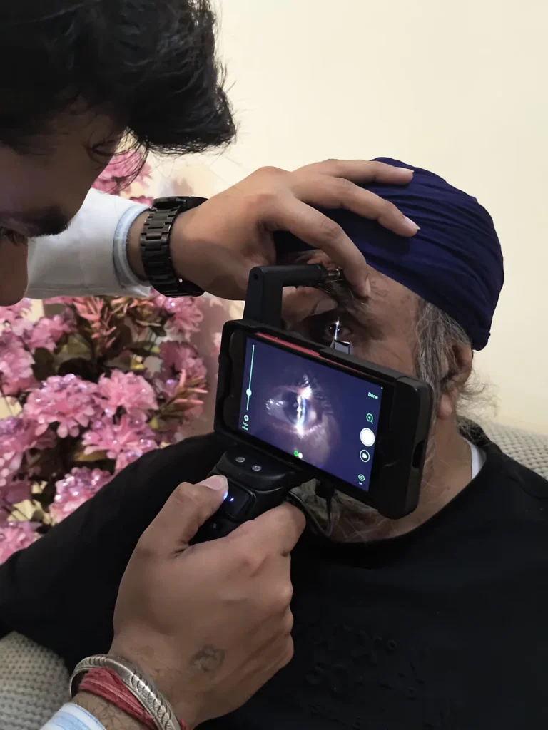 Close-up of a phone-based eye camera during a home exam